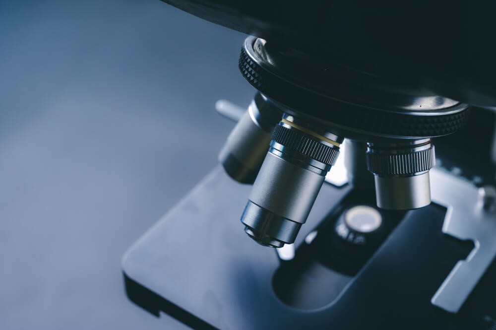 Factors Influencing Xanthelasma Size and Duration